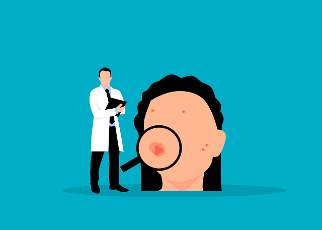 Acne-Prone Skin Causes, treatment and solution
